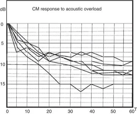 Acoustic overload leading to ear fatigue