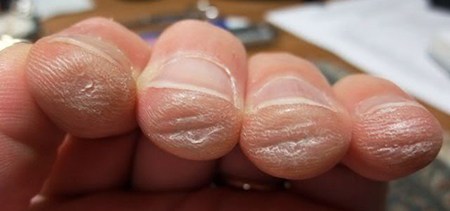 How to Build Guitar Calluses: Take Care of Your Fingers! | LedgerNote